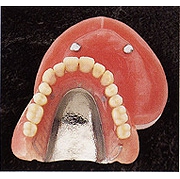 磁石式義歯