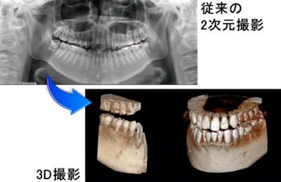 従来のレントゲンとの違い