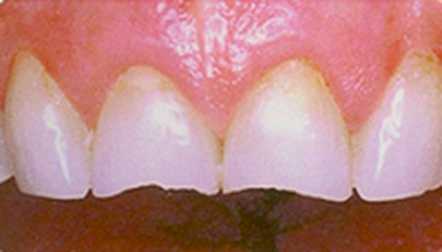 処置前のイメージ