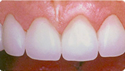 処置後のイメージ