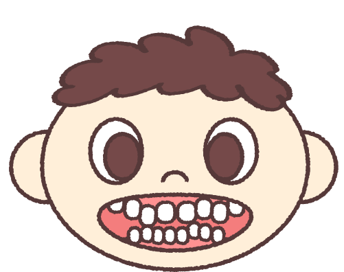 上顎前突のイメージ