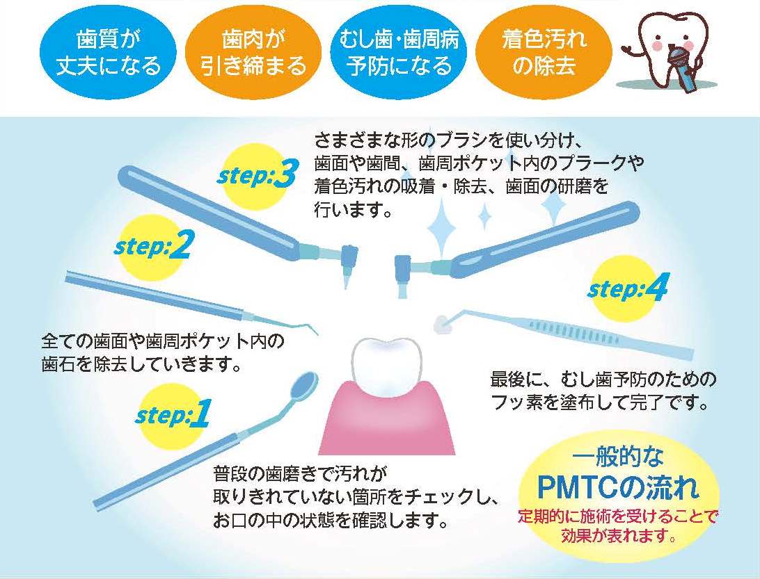 PMTCの効果のイラスト