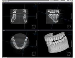 治療シミュレーション