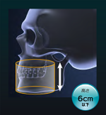 低被ばく線量を実現